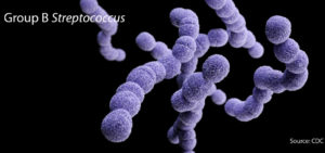 Group B streptococcus