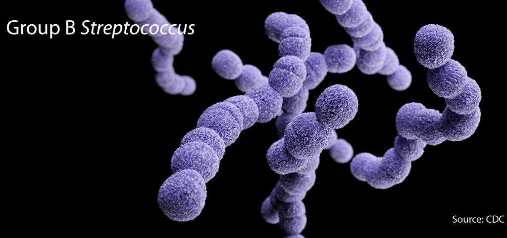Group_B_Streptococcus_web
